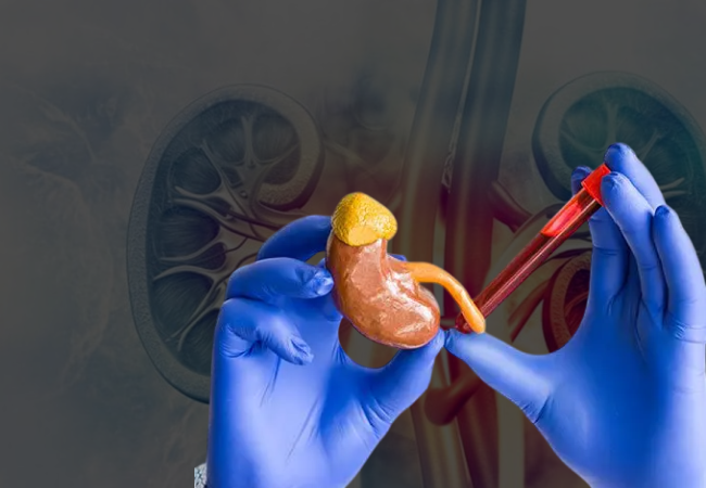 Everything You Need to Know About High Creatinine Levels
