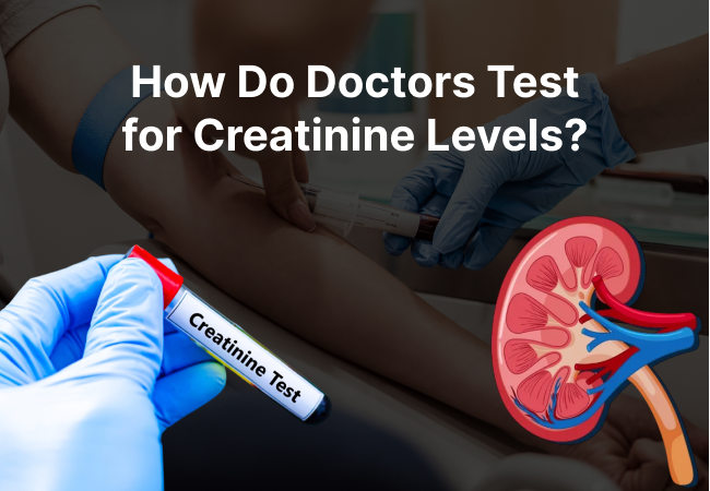 How Do Doctors Test for Creatinine Levels