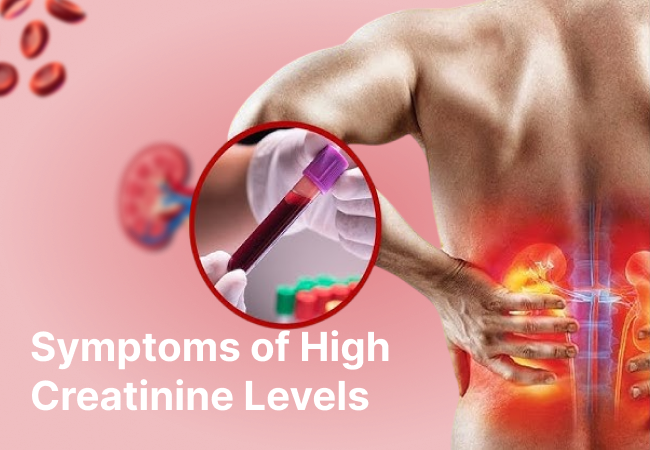 Symptoms of High Creatinine Levels