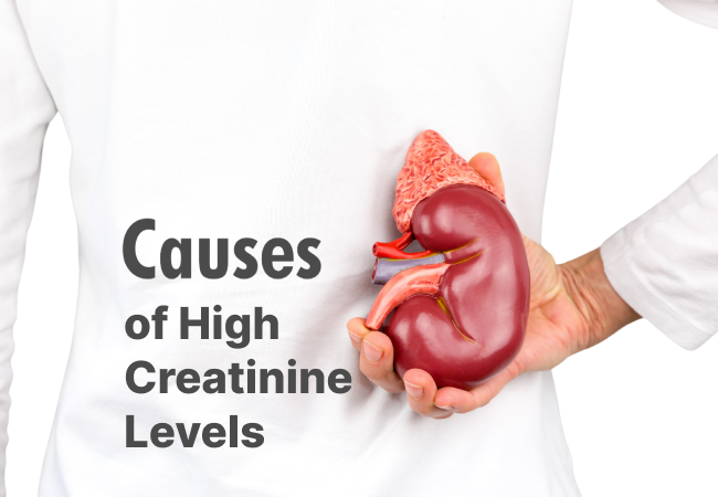 Causes of High Creatinine Levels