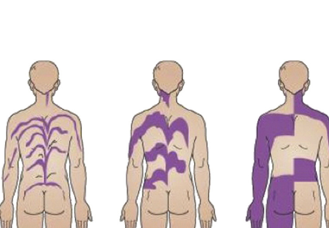 Humans Have Secret Stripes: Hidden Skin Patterns Explained