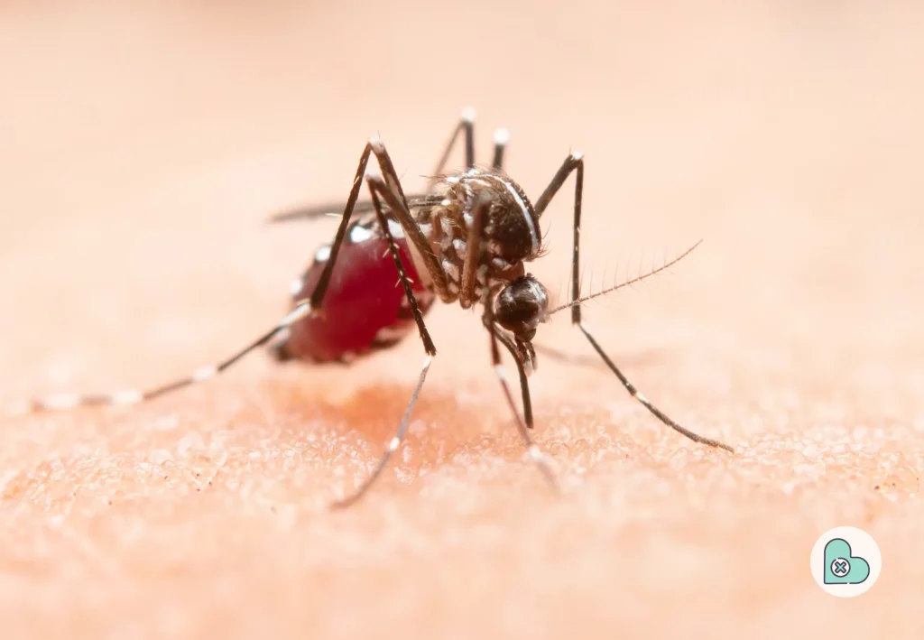 Mosquito-Bites-_-jcomp-