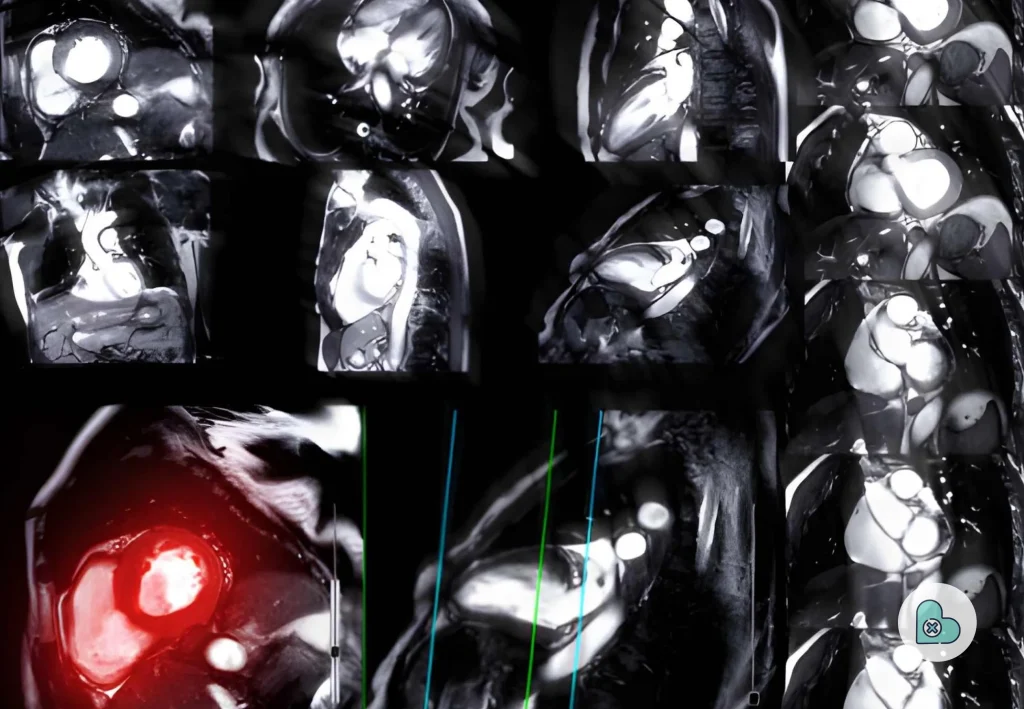 What Exactly is Cardiac Imaging_ _ mr.suphachai praserdumrongchai 
