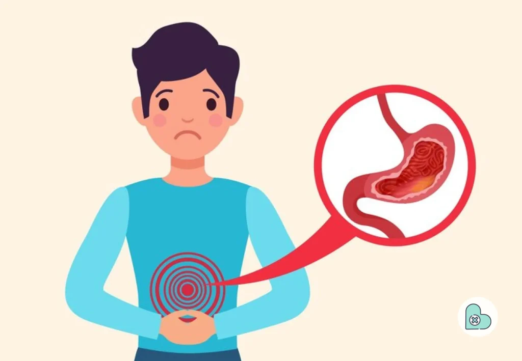 What Is GERD_ Understanding the Condition 
