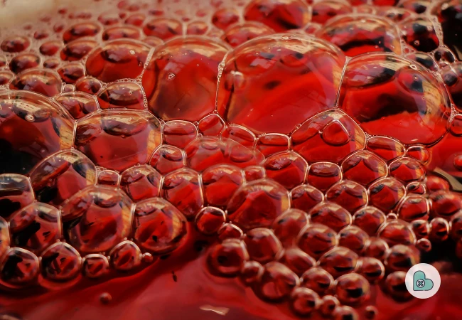 What Are the Most Common Signs and Symptoms of Iron-Deficiency Anemia?